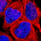 Immunofluorescent staining of human cell line A-431 shows localization to nuclear bodies.