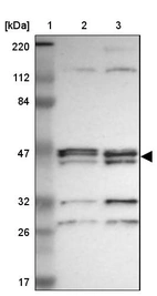 Lane 1: Marker [kDa] 220, 112, 84, 47, 32, 26, 17_br/_Lane 2: Human cell line RT-4_br/_Lane 3: Human cell line U-251MG sp
