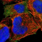 Immunofluorescent staining of human cell line A-431 shows localization to cytosol, actin filaments & focal adhesion sites.