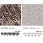 Anti-SERINC2 Antibody