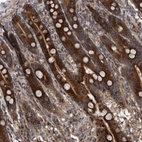 Immunohistochemical staining of human duodenum shows high expression.