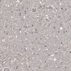 Immunohistochemical staining of human cerebral cortex shows low expression as expected.