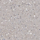 Immunohistochemical staining of human cerebral cortex shows low expression as expected.