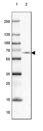 Lane 1: Marker [kDa] 250, 130, 100, 70, 55, 35, 25, 15, 10_br/_Lane 2: Human Esophagus tissue