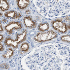 Immunohistochemical staining of human kidney shows strong cytoplasmic positivity in cells in tubules.