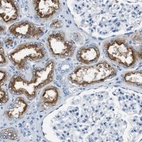 Immunohistochemical staining of human kidney shows strong cytoplasmic positivity in cells in tubules.