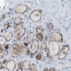 Immunohistochemical staining of human thyroid gland shows moderate to strong cytoplasmic positivity in glandular cells.