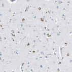 Anti-LRP2 Antibody