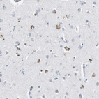 Immunohistochemical staining of human cerebral cortex shows moderate cytoplasmic positivity in neuronal cells.