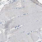 Immunohistochemical staining of human skeletal muscle shows no positivity in myocytes as expected.