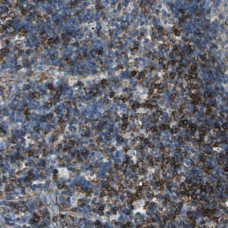 Anti-RPS13 Antibody