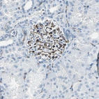 Immunohistochemical staining of human kidney shows strong membraneous positivity in cells in glomeruli.