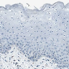 Immunohistochemical staining of human skin shows no positivity as expected.