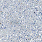 Anti-RPS13 Antibody