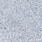 Immunohistochemical staining of human liver shows no positivity as expected.