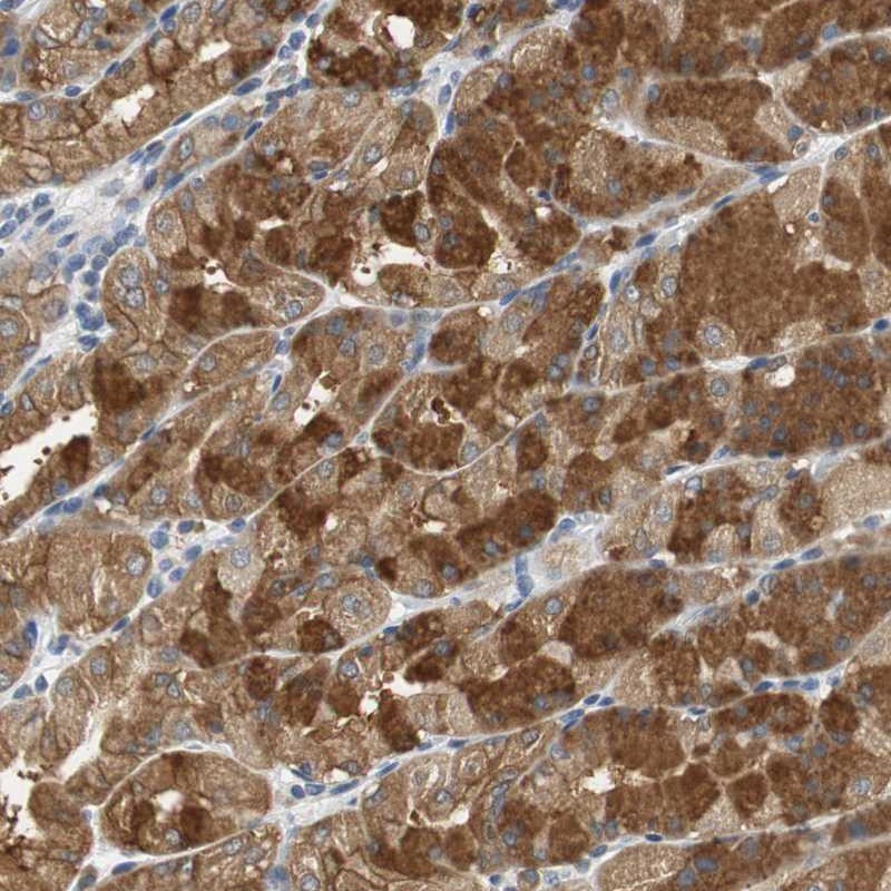 Anti-GLCCI1 Antibody
