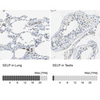 Anti-SELP Antibody