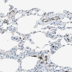 Immunohistochemical staining of human lung shows high expression.