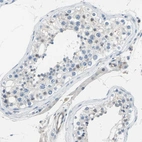 Immunohistochemical staining of human testis shows low expression as expected.