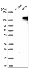 Western blot analysis in control (vector only transfected HEK293T lysate) and SELP over-expression lysate (Co-expressed with a C-terminal myc-DDK tag (~3.1 kDa) in mammalian HEK293T cells, LY418960).