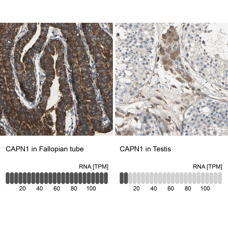 Anti-CAPN1 Antibody