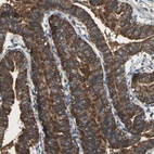 Immunohistochemical staining of human fallopian tube shows high expression.