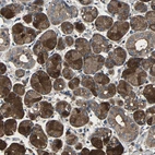 Immunohistochemical staining of human salivary gland shows strong cytoplasmic positivity in glandular cells.