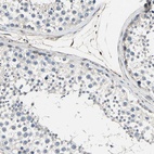 Immunohistochemical staining of human testis shows low expression as expected.