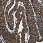 Immunohistochemical staining of human fallopian tube shows strong membranous positivity in glandular cells.