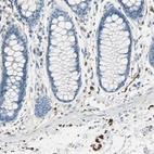 Anti-UCHL1 Antibody