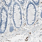 Immunohistochemical staining of human rectum shows strong cytoplasmic positivity in peripheral ganglion and peripheral nerves.