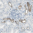 Immunohistochemical staining of human kidney shows moderate cytoplasmic positivity in cells in tubules.
