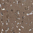 Immunohistochemical staining of human cerebral cortex shows strong cytoplasmic positivity in neurons and in neuropil.