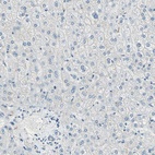 Immunohistochemical staining of human liver shows no positivity in hepatocytes, as expected.