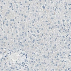 Immunohistochemical staining of human liver shows no positivity in hepatocytes, as expected.