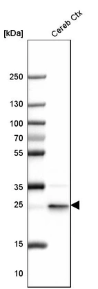 Western blot analysis in mouse cerebral cortex tissue.