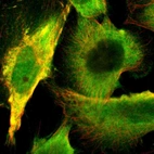 Immunofluorescent staining of human cell line U-251 MG shows localization to nucleoplasm & cytosol.