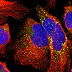 Immunofluorescent staining of human cell line U-2 OS shows localization to vesicles.