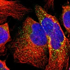 Immunofluorescent staining of human cell line U-2 OS shows localization to vesicles.