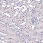Immunohistochemical staining of human kidney shows no positivity in cells in tubules as expected.