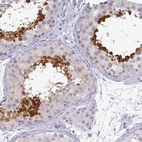 Immunohistochemical staining of human testis shows strong cytoplasmic and nuclear positivity in spermatids.