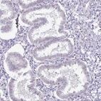 Immunohistochemical staining of human endometrium shows no positivity in glandular cells as expected.