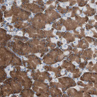 Immunohistochemical staining of human stomach shows strong cytoplasmic positivity in glandular cells.