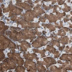 Immunohistochemical staining of human stomach shows strong cytoplasmic positivity in glandular cells.