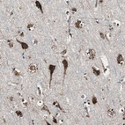 Immunohistochemical staining of human cerebral cortex shows strong cytoplasmic positivity in neurons.