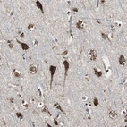 Immunohistochemical staining of human cerebral cortex shows strong cytoplasmic positivity in neurons.