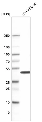 Western blot analysis in human cell line SK-MEL-30.