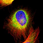 Immunofluorescent staining of human cell line U-251 MG shows localization to endoplasmic reticulum.