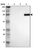 Lane 1: Marker [kDa] 220, 112, 84, 47, 32, 26, 17_br/_Lane 2: Human cell line RT-4_br/_Lane 3: Human cell line U-251MG sp_br/_Lane 4: Human plasma (IgG/HSA depleted)