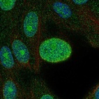 Anti-CDK4 Antibody